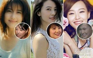 龅牙男明星,龅牙男明星的蜕变历程